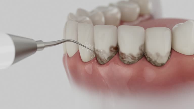 Trusted Teeth Cleaning And Checkup service in Avila Beach, CA - Dentist Open Now